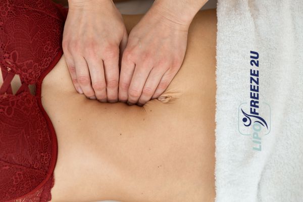 diastasis recti treatment Ruislip