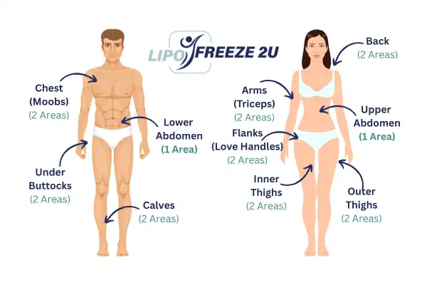 Areas you can have fat freezing treatment Ruislip