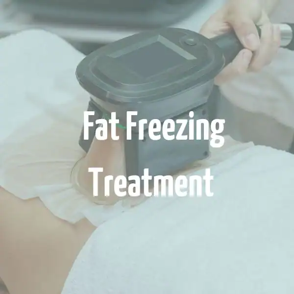 fat freezing treatment Ruislip