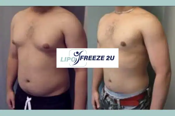 How Long Does It Take to See Results Ruislip?