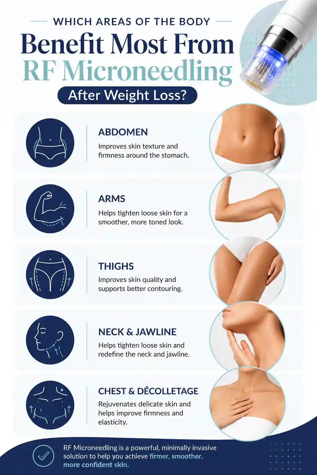 Which Areas of the Body Benefit Most From RF Microneedling After Weight Loss Ruislip
